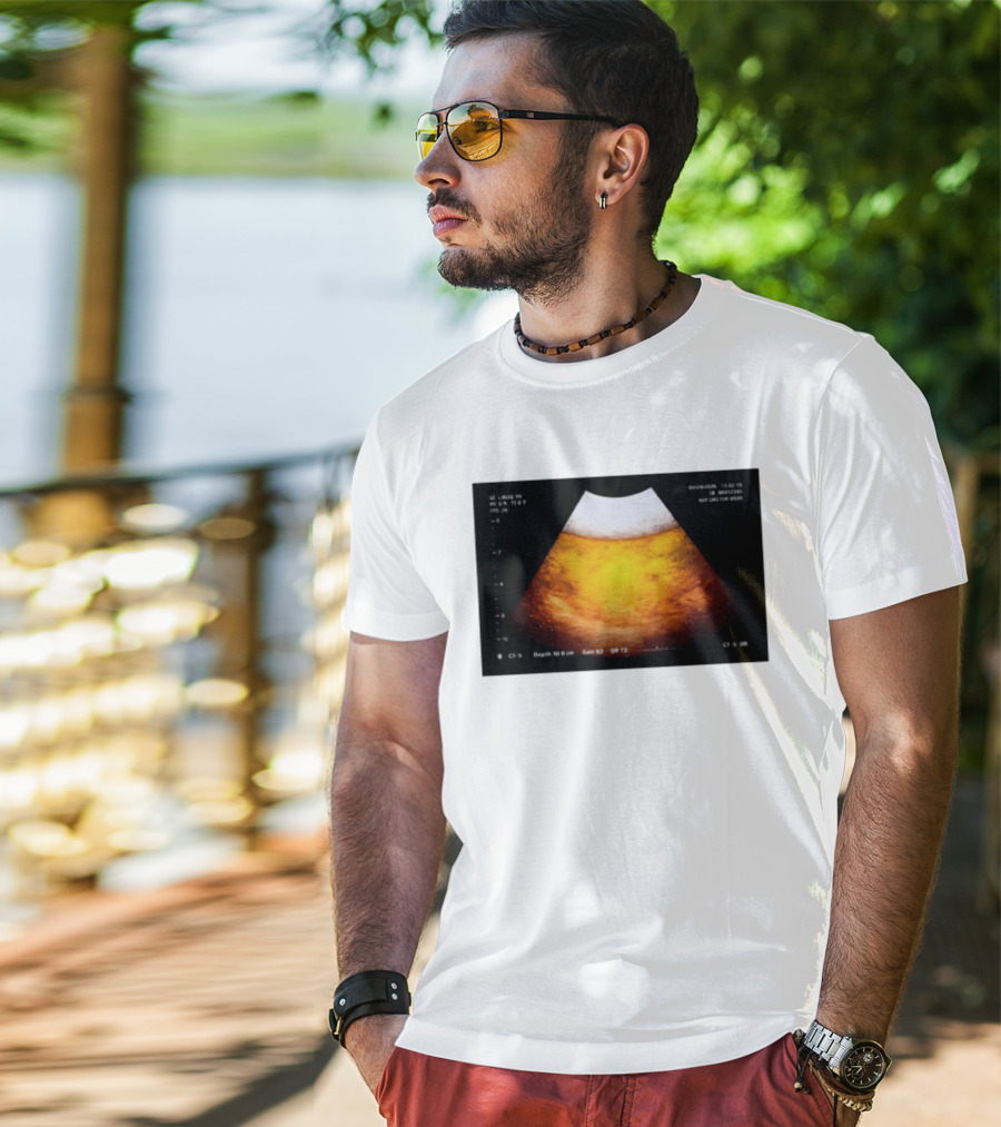 Beer Ultrasound Image Not Safe For Liver T-Shirt