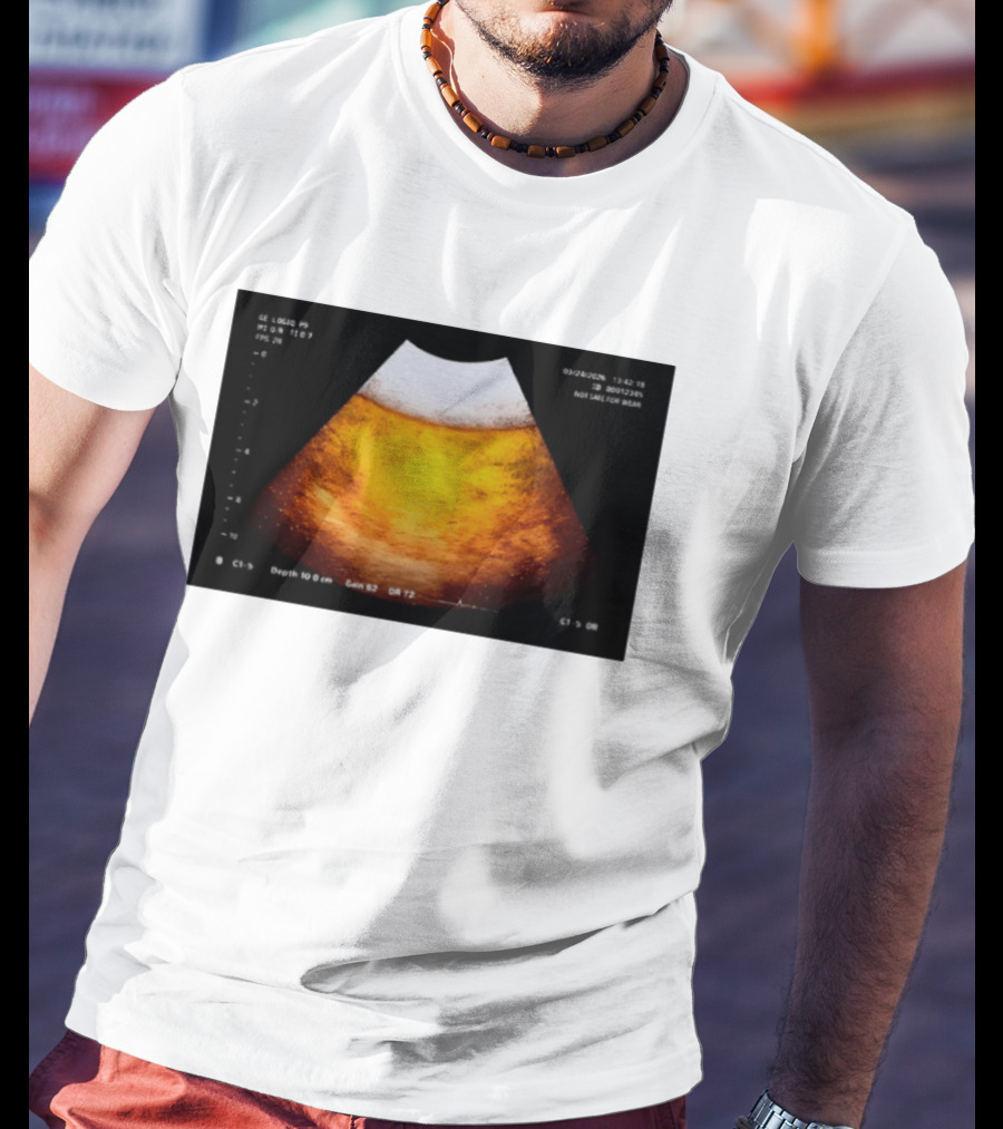 Beer Ultrasound Image Not Safe For Liver T-Shirt