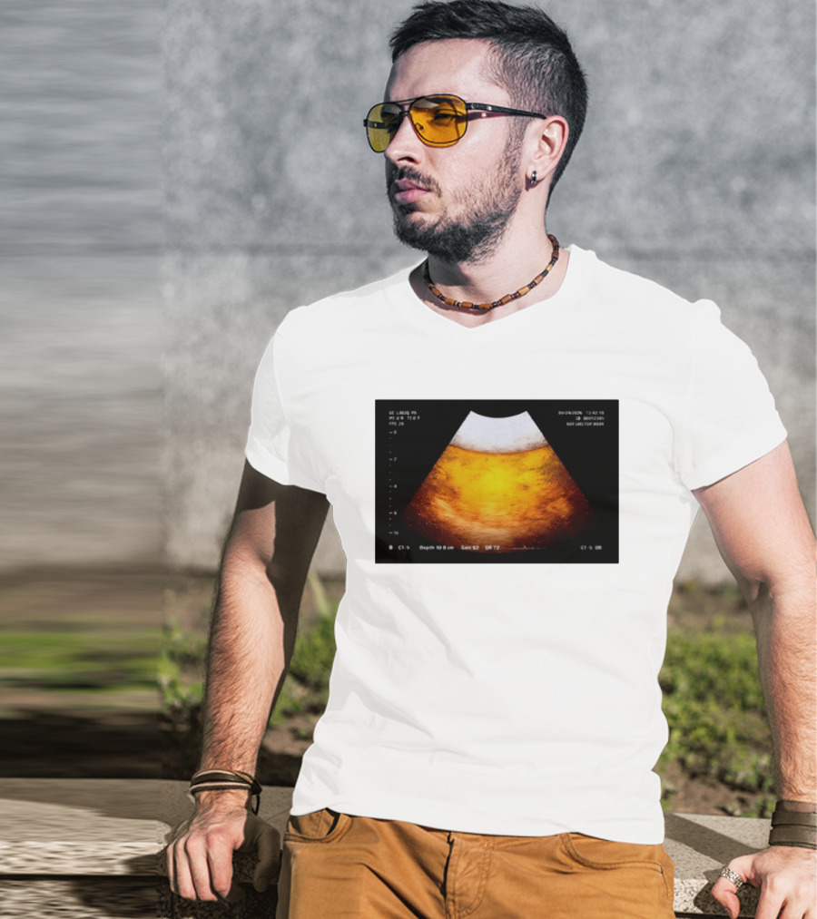 Beer Ultrasound Image Not Safe For Liver T-Shirt
