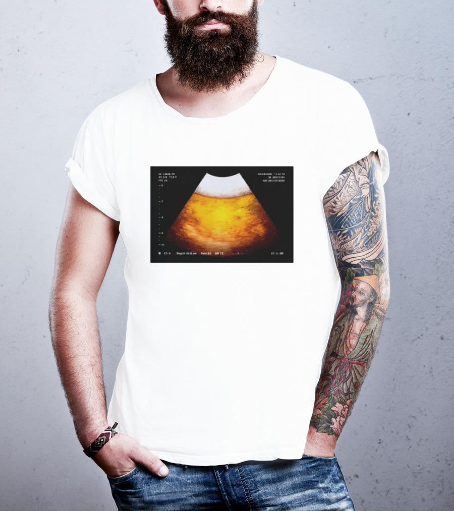 Beer Ultrasound Image Not Safe For Liver T-Shirt