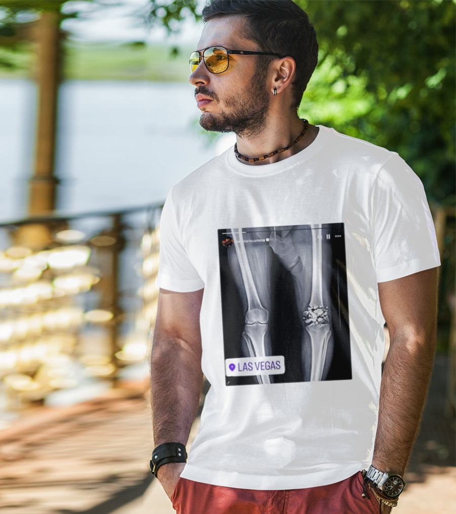 Conor McGregor X Ray Broken Knee Las Vegas T-Shirt