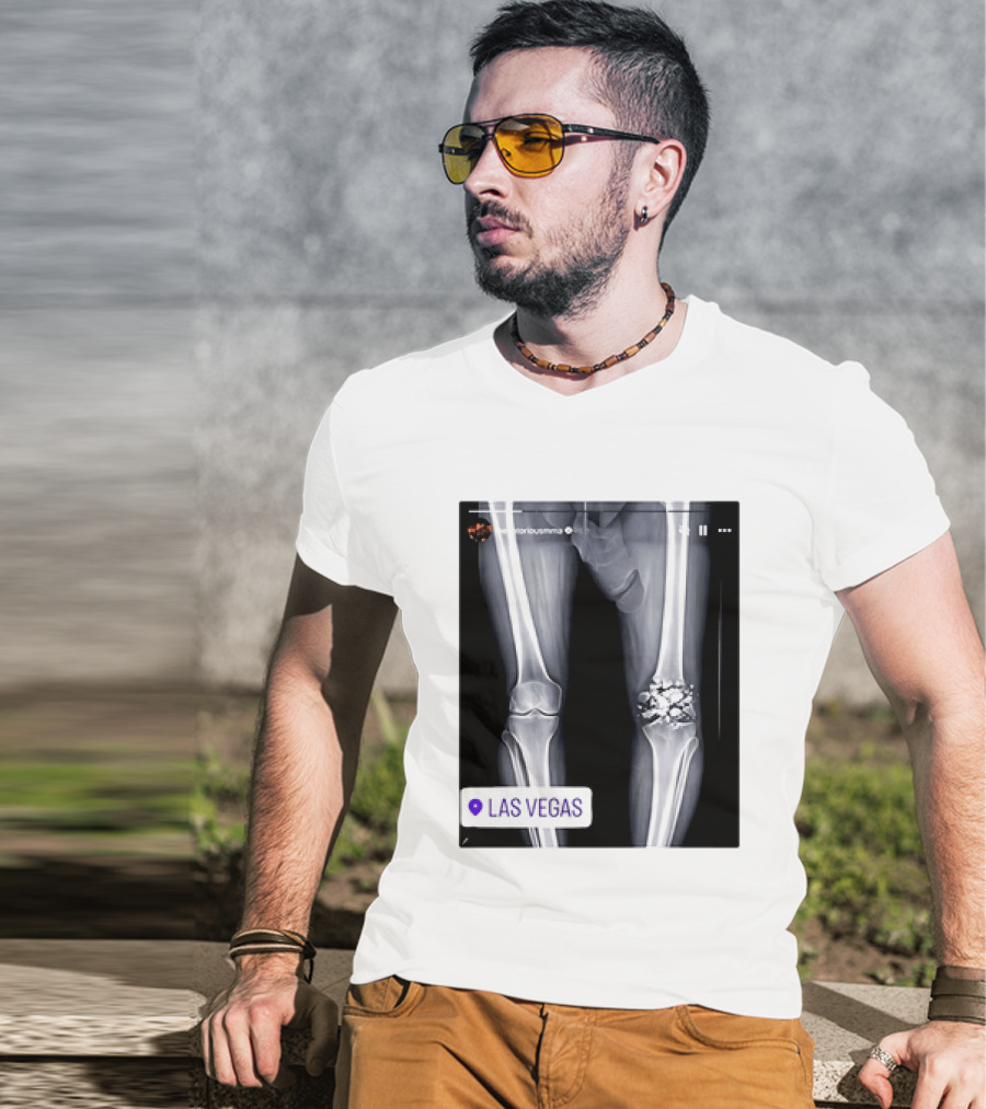 Conor McGregor X Ray Broken Knee Las Vegas T-Shirt