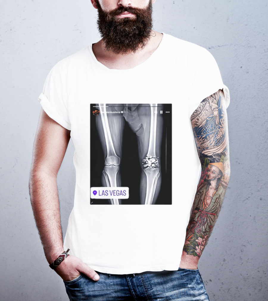Conor McGregor X Ray Broken Knee Las Vegas T-Shirt